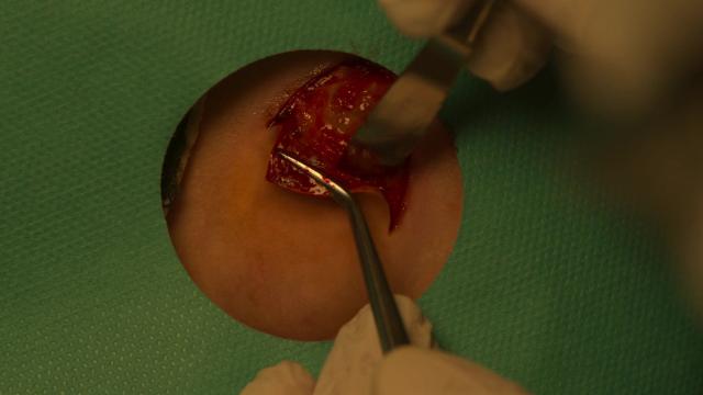 9 серия, 1 сезона, сериала Мы все мертвы (2022)